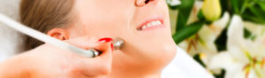 Microdermabrasion Treatments